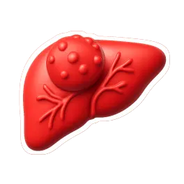 khối u 肿瘤