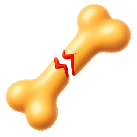 gãy xương 骨折