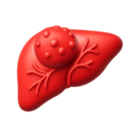 khối u 肿瘤